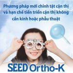 Ortho-K, kính tiếp xúc chỉnh hình giác mạc điều trị cận thị không phẫu thuật